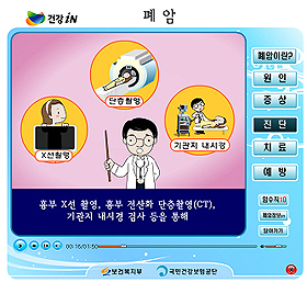 공단, '건강in' 통해 건강 동영상 서비스
