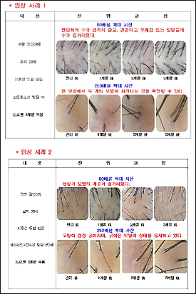 태전약품, 주력 PB제품 드로젠 임상 시행