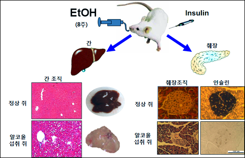 "과도한 음주, 당뇨병 원인"…국내 연구진 최초 규명