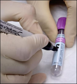 환자 적은 신약, PMS 조사대상자 탄력적용 허용