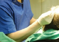 강남지역 피부·성형외과, 무자격자 모발이식 횡행