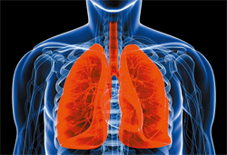 COPD 새 치료 가이드라인, 지속성항콜린제 권장