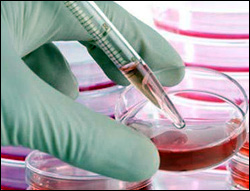 세포치료제 1세대 가시밭길…품목 허가취하 잇따라