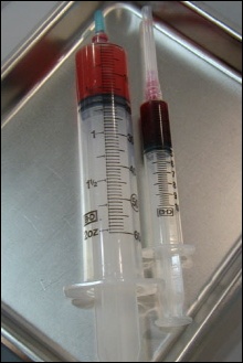 휴온스 "PRP 신의료기술 인증 포기 않는다"