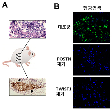 류마티스 관절염서 뼈-연골 파괴 기전 최초 규명