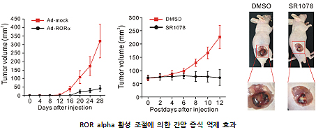 간암 대사 제어로 증식억제 규명…치료제 개발 '물꼬'
