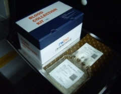 셀텍 '엔케이엠주', 증례수 미달로 허가취소 위기