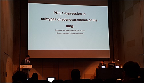한국인 폐암 환자, 실제 'PD-L1 양성률' 얼마?