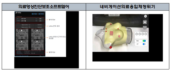 증강현실 적용 암수술 보조제품 등 혁신의료기기 지정